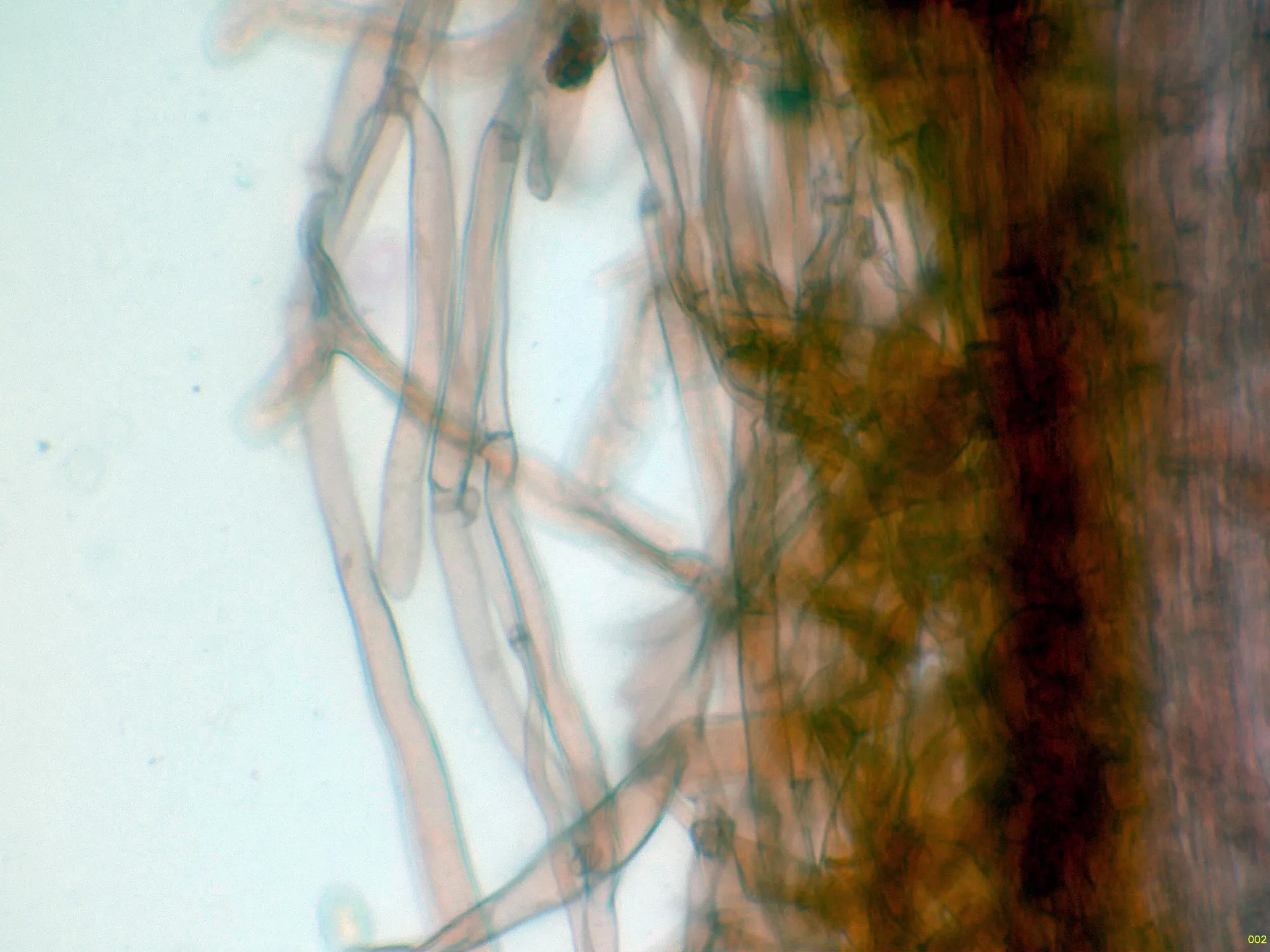 Microscopía de Inocybe flocculosa - 10 - Hifas bajo pie x 600-002